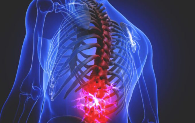 Spinal Deformity Spine